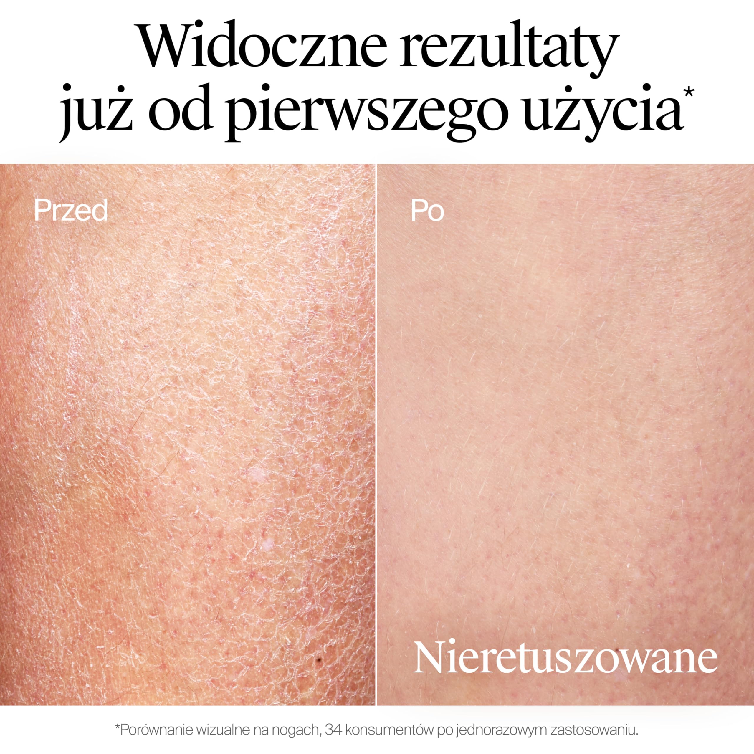NEUTROGENA® Formuła Norweska Głęboko Nawilżający Szybko Wchłaniający się Balsam do Ciała 400ml, Głęboko nawilżający balsam do skóry suchej. Trzykrotnie zwiększa nawilżenie skóry. Bezzapachowy.