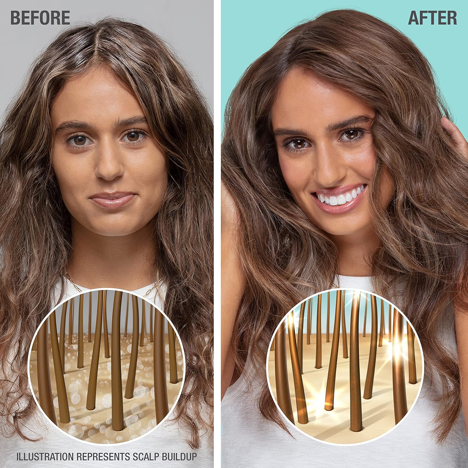 Neutrogena Gentle & Soft Healthy Scalp Shampoo for Sensitive Scalp & Lightweight Moisture, with Micellar Water, pH-Balanced, Paraben & Phthalate-Free, Color-Safe, 12oz : Everything Else