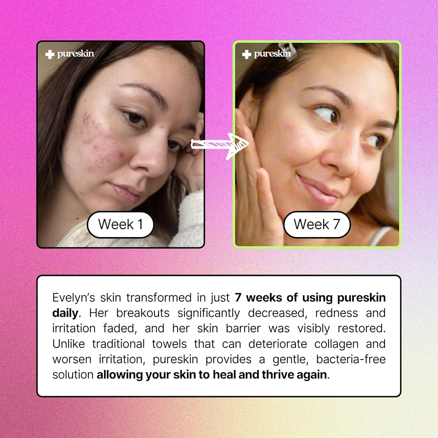 pureskin Daily Clean Facial Towels, 100% Biodegradable Pure Cotton, Premium Disposable Face Towels, Clinician Recommended, Ultra Soft, Suitable for All Skin Types, 50 count - Image 5