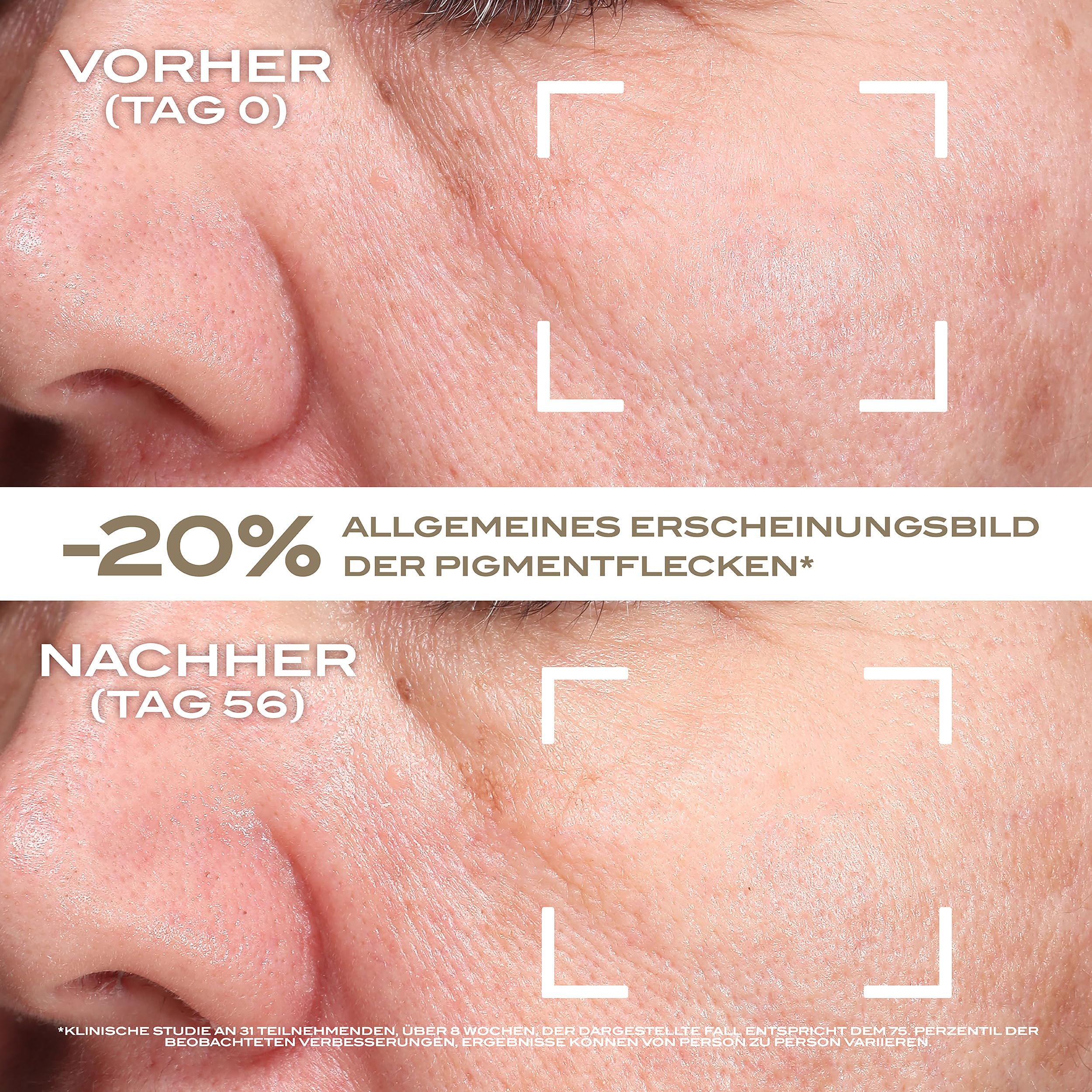 Lancaster Golden Lift Overnight Age-Defying Cream – Mit Retinol + Retinal – Bekämpft Anzeichen lichtbedingter Hautalterung – Kationisches liposomales Retinol – Mindert Pigmentflecken + Falten, 50 ml