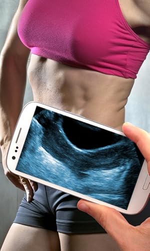 Ultrasound Scanner