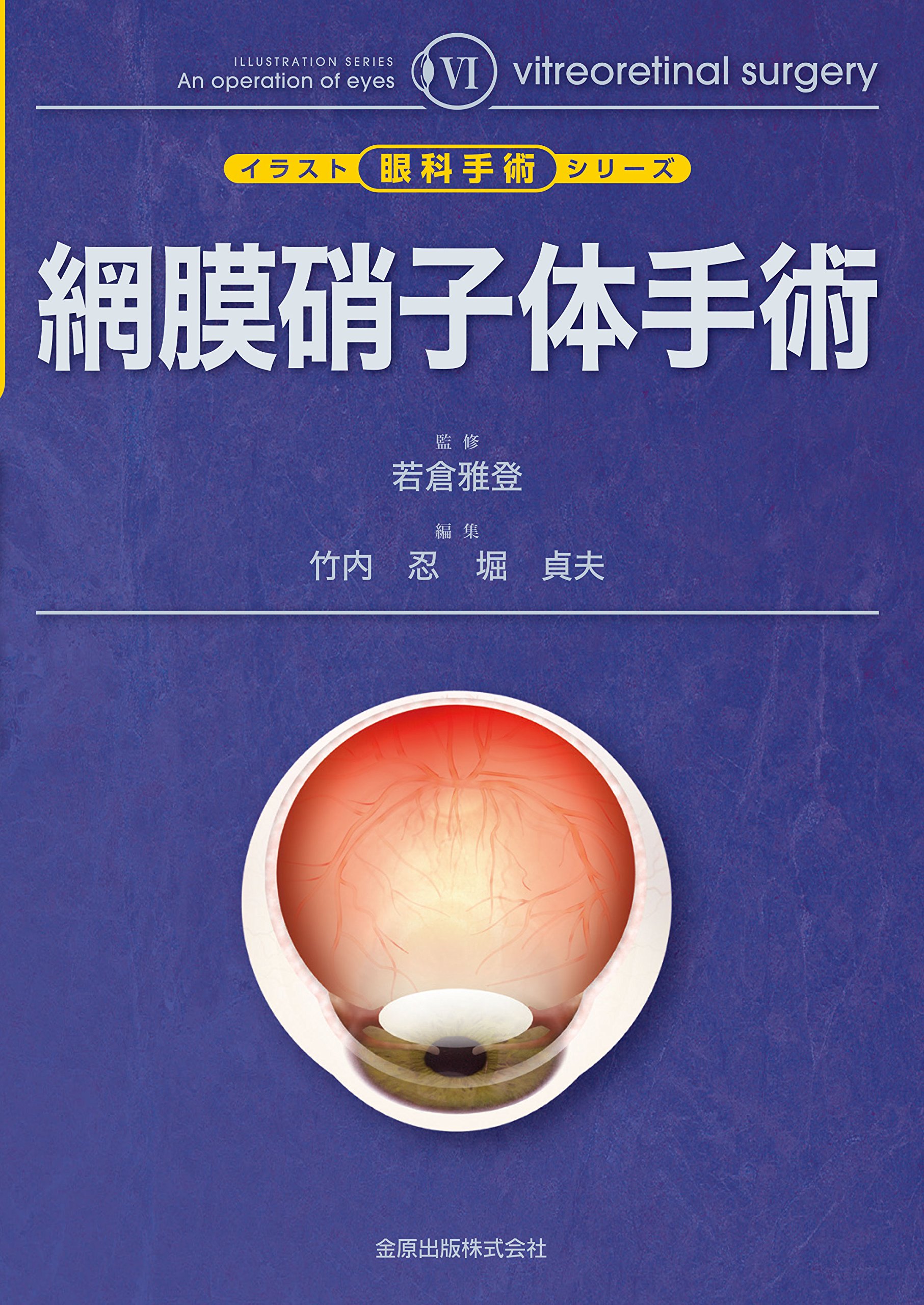 網膜硝子体手術 イラスト眼科手術シリーズ 6 若倉 雅登 竹内 忍 堀 貞夫 本 通販 Amazon 網膜硝子体手術 イラスト眼科手術シリーズ 6 若倉 雅登 竹内 忍 堀 貞夫 本 通販 Amazon