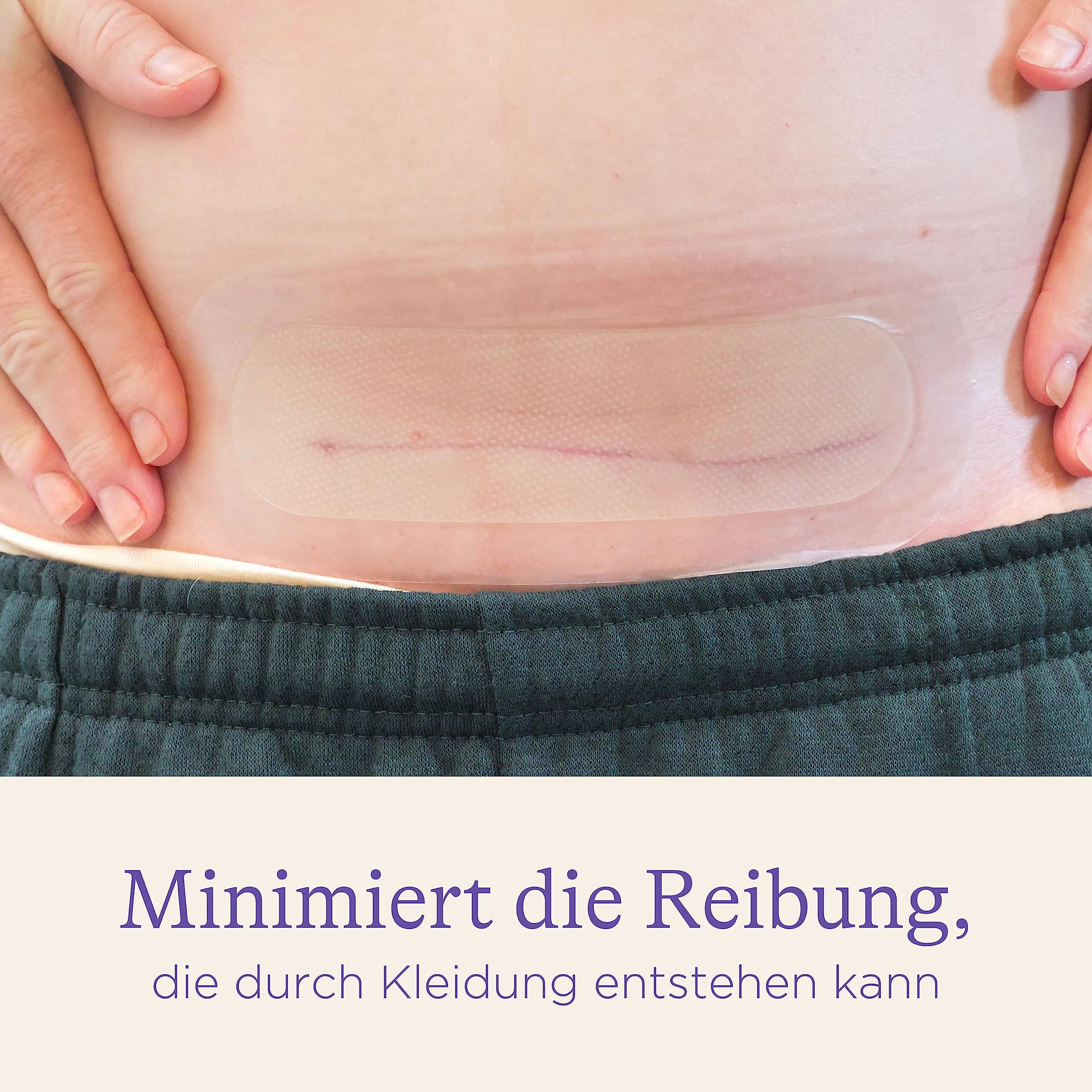 Lansinoh Kaiserschnitt Hydrogel Pads - schützen, beruhigen & kühlen die Kaiserschnittnarbe – wasserbeständig - Narbenpflaster zur Kaiserschnitt Narbenpflege - 2 Stück