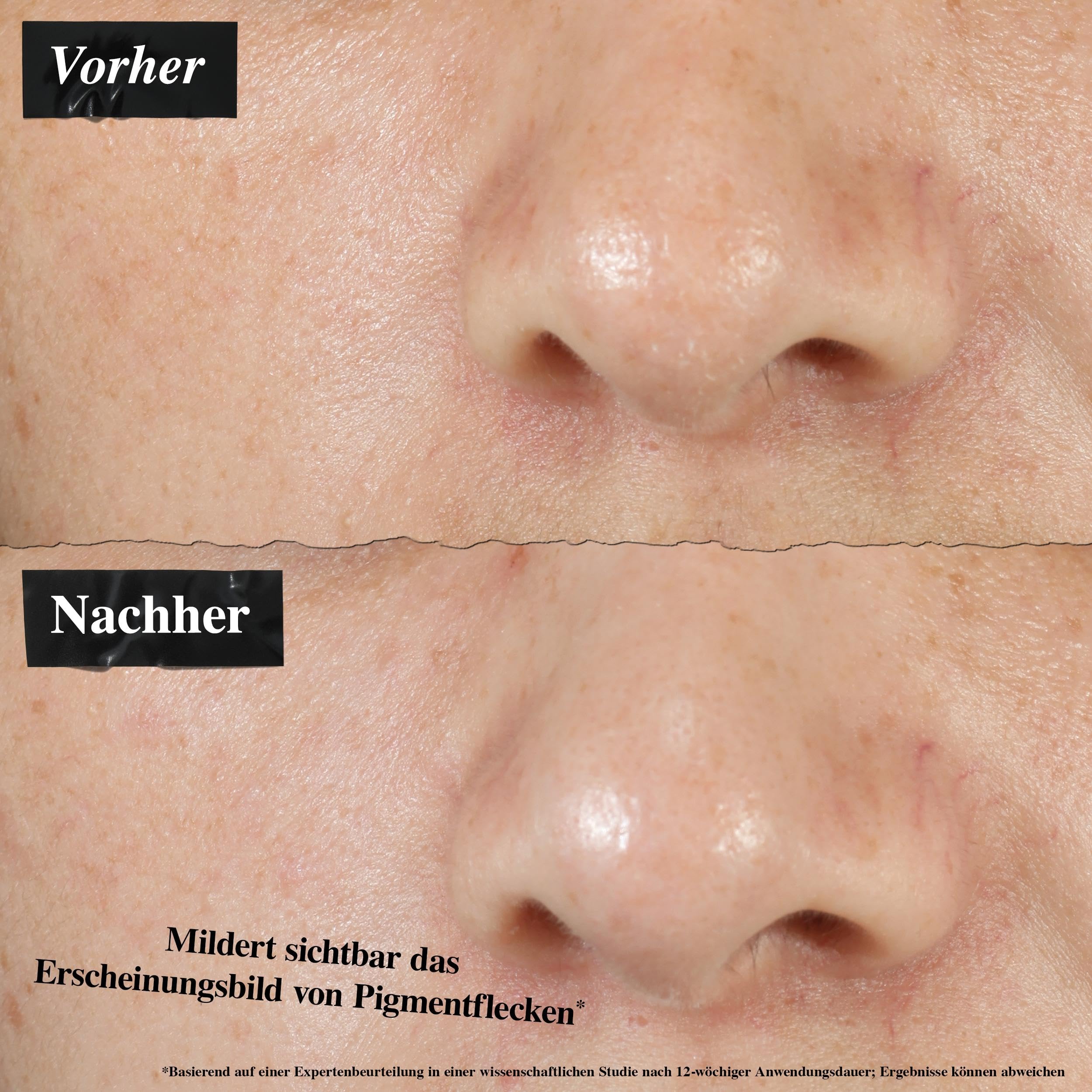 KIEHL'S Clearly Corrective Dark Spot Solution, schnell wirkendes Gesichtsserum zur Verminderung dunkler Flecken, reduziert Hautverfärbungen