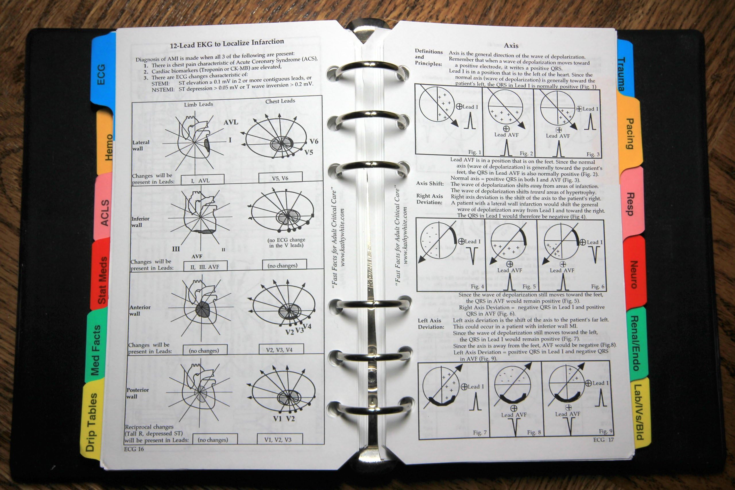 Fast Facts for Adult Critical Care Ring-bound – Import, 30 June 2005