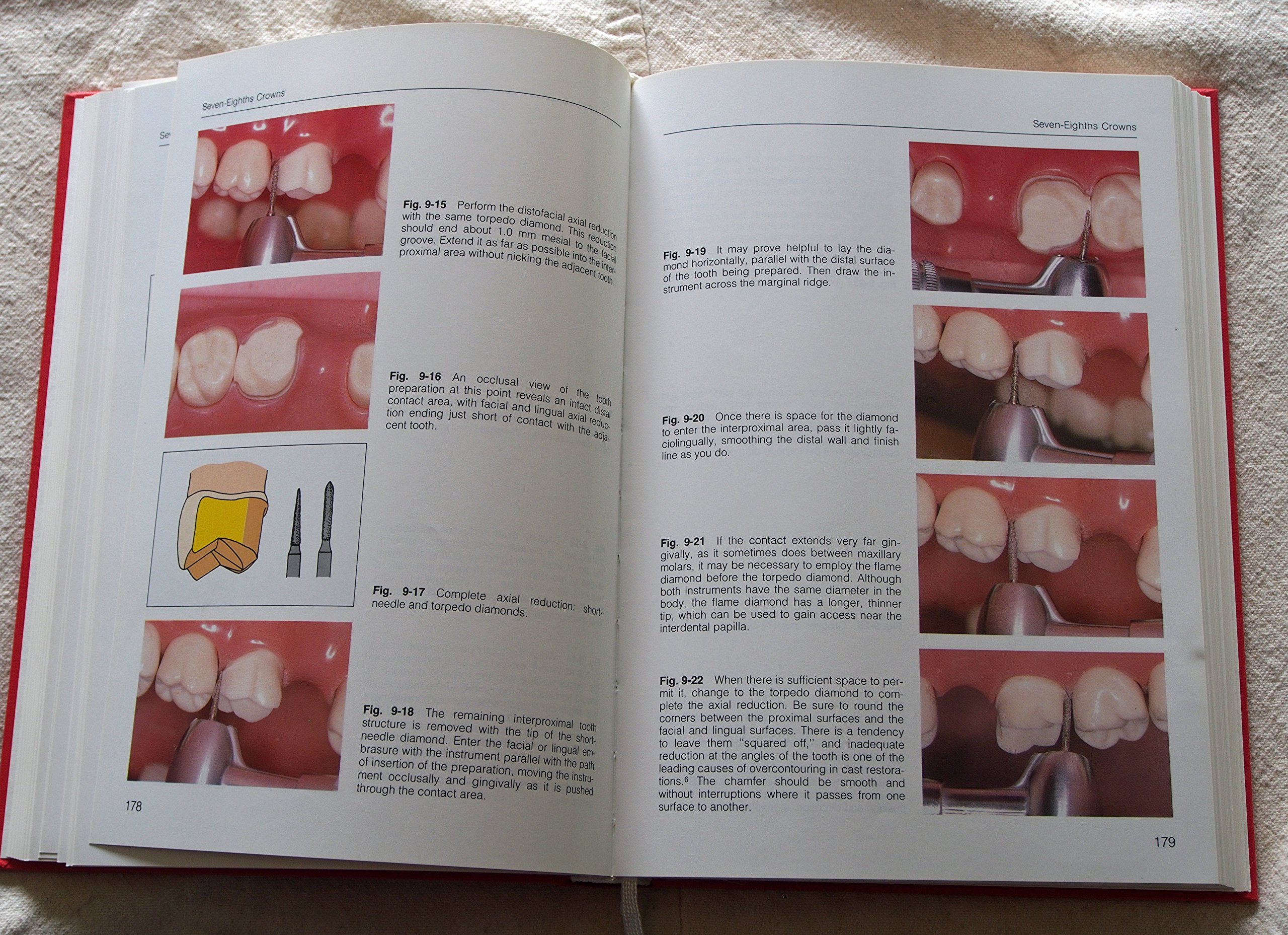 Amazon.com: Herbert T. Shillingburg: books, biography, latest update