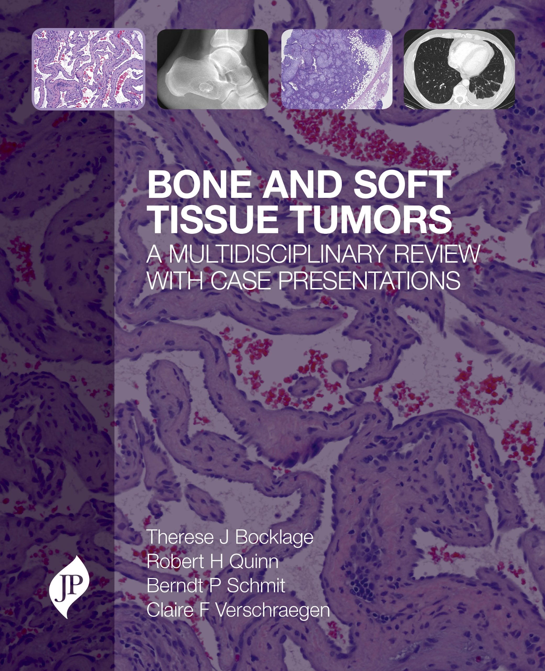 Buy Bone and Soft Tissue Tumors Book Online at Low Prices in India ...