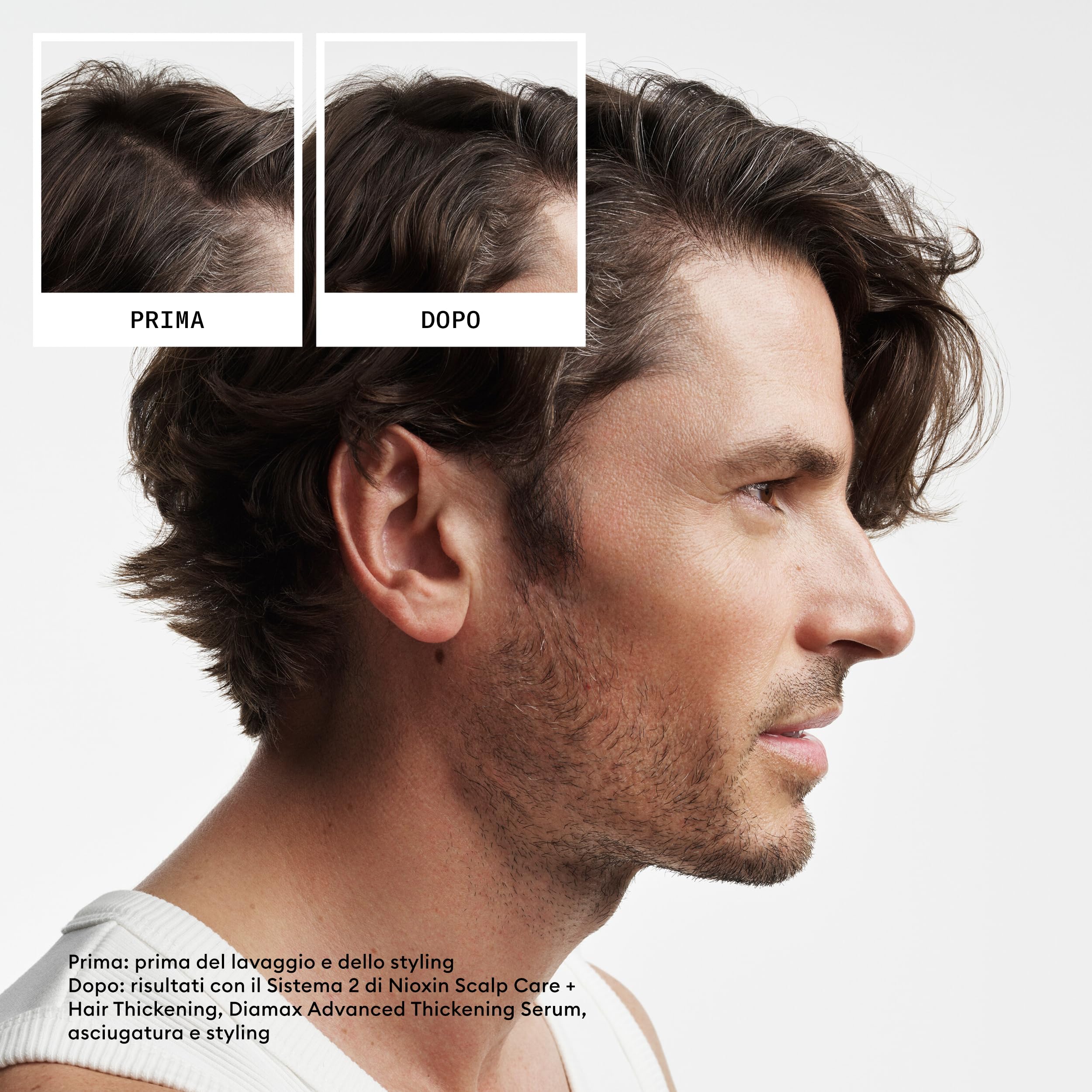 Nioxin Scalp + Hair Thickening Sistema 2 Shampoo, Balsamo, Trattamento Cuoio Capelluto per Capelli Naturali con Assottigliamento Avanzato