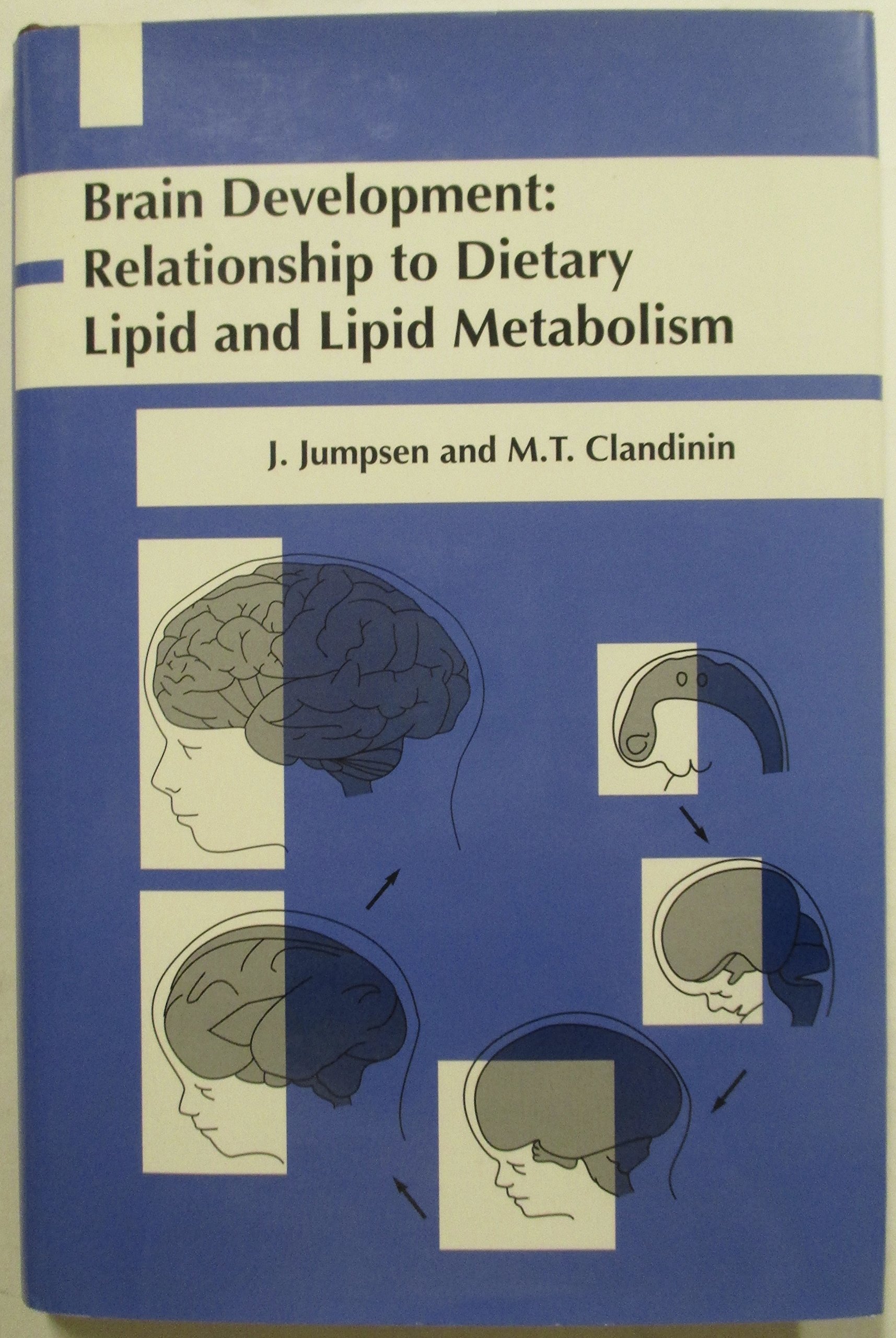 Buy Brain Development: Relationship to Dietary Lipid and Lipid Metabolism — BookShops.in