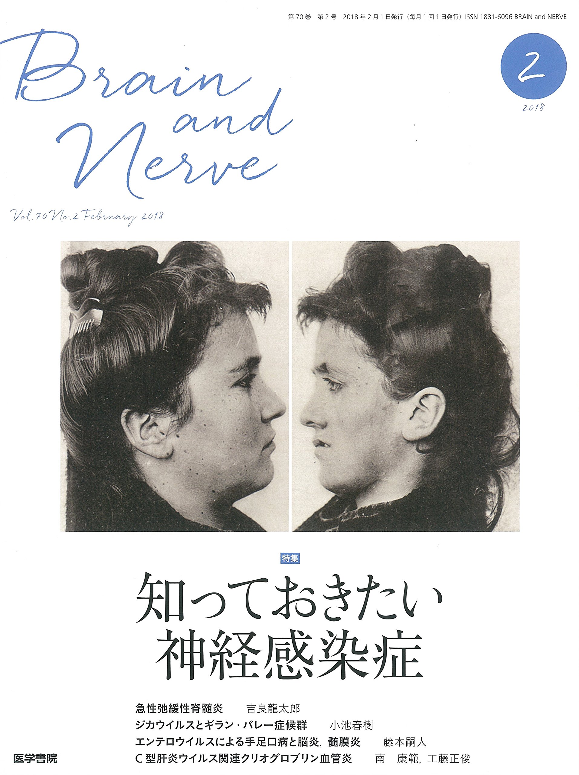 BRAIN AND NERVE (ブレイン・アンド・ナーヴ) ー 神経研究の進歩 楽天ブックス: BRAIN AND NERVE (ブレイン・アンド・ナーヴ