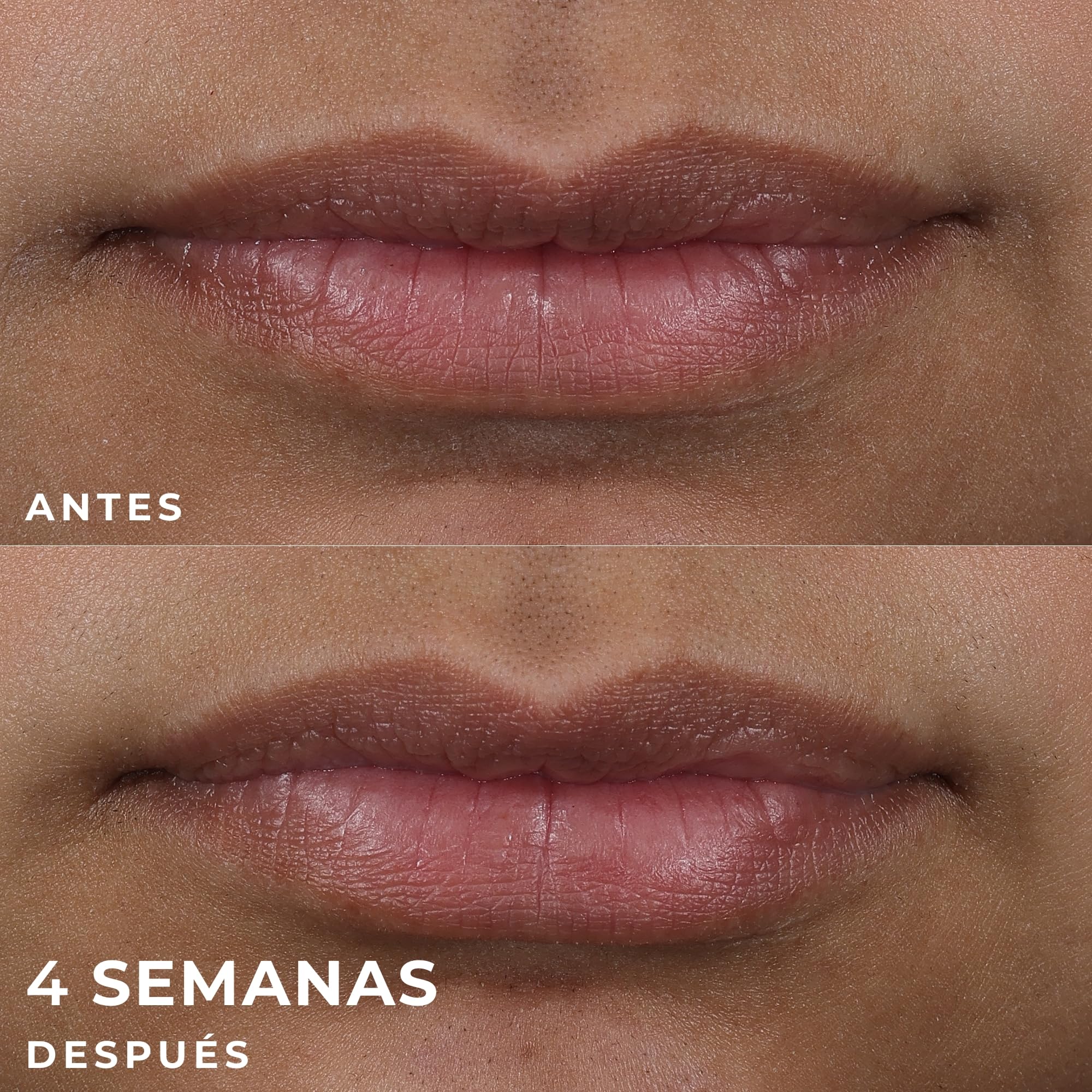 RoC Derm Correxion Lip Volumizer | Bálsamo Rellenador para Labios con Ácido Hialurónico y Péptidos de Colágeno | 10 ml