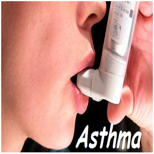 Asthma