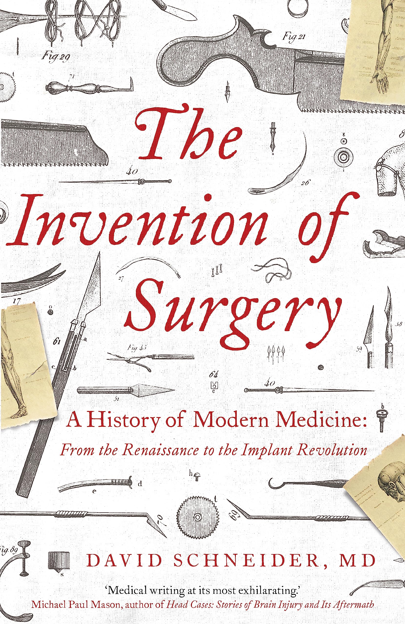 The Invention of Surgery