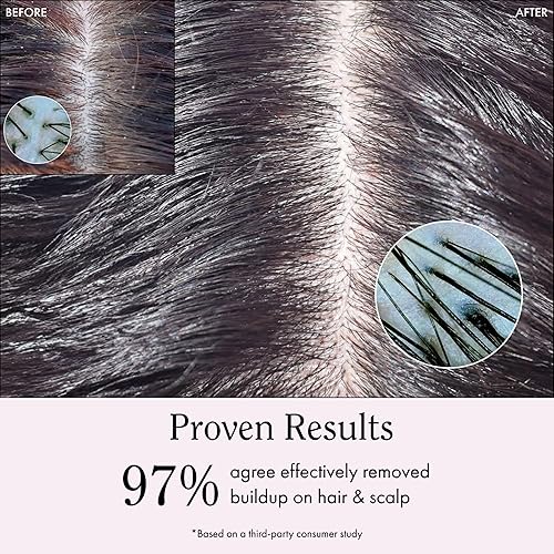 Miniatura 10 de Rizos Curls Vinagre de sidra de manzana para el cuero cabelludo y el cabello