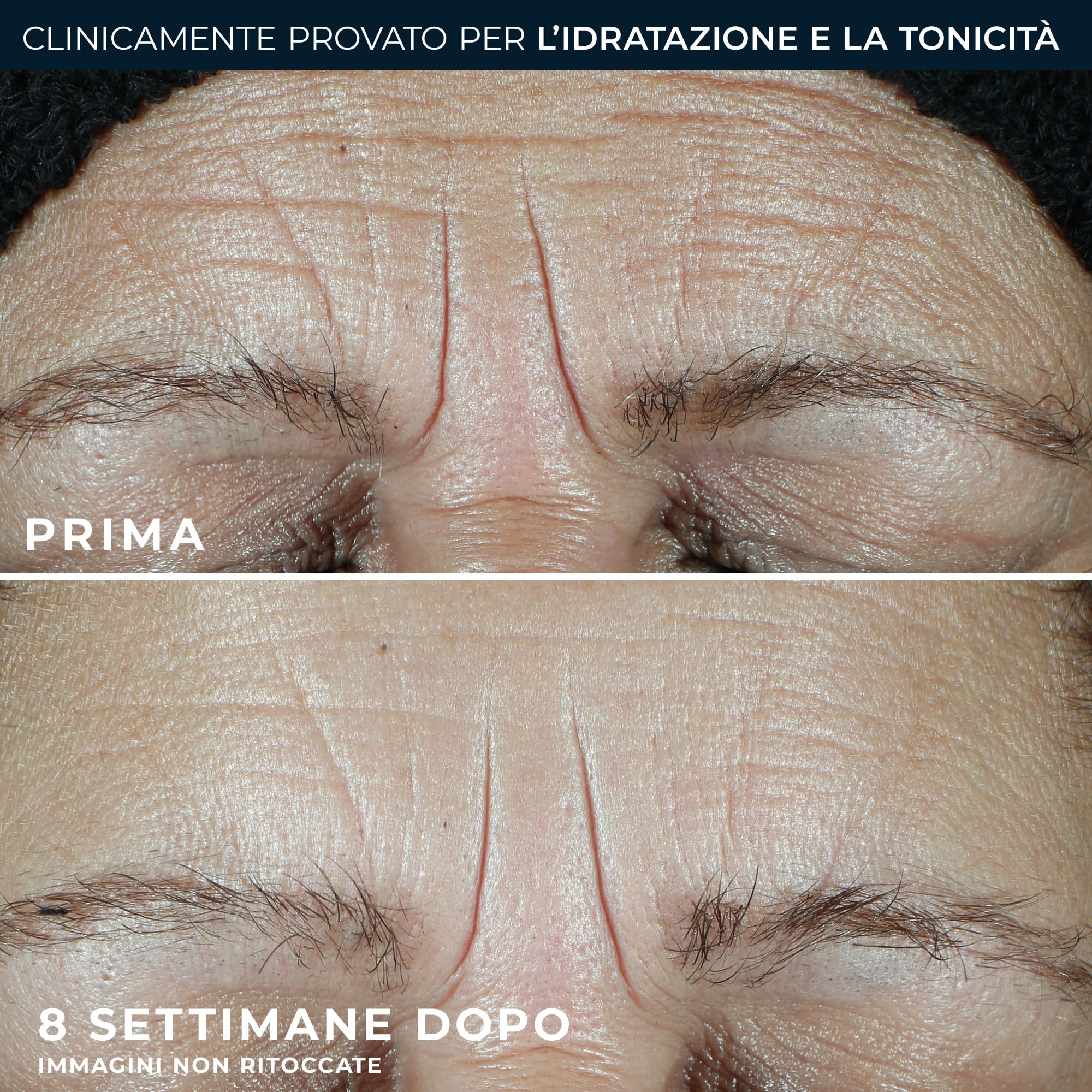 RoC - Multi Correxion Hydrate + Plump Moisturizer SPF30 - Trattamento Antirughe - Protezione Dai Raggi UVA/UVB B - 50ML
