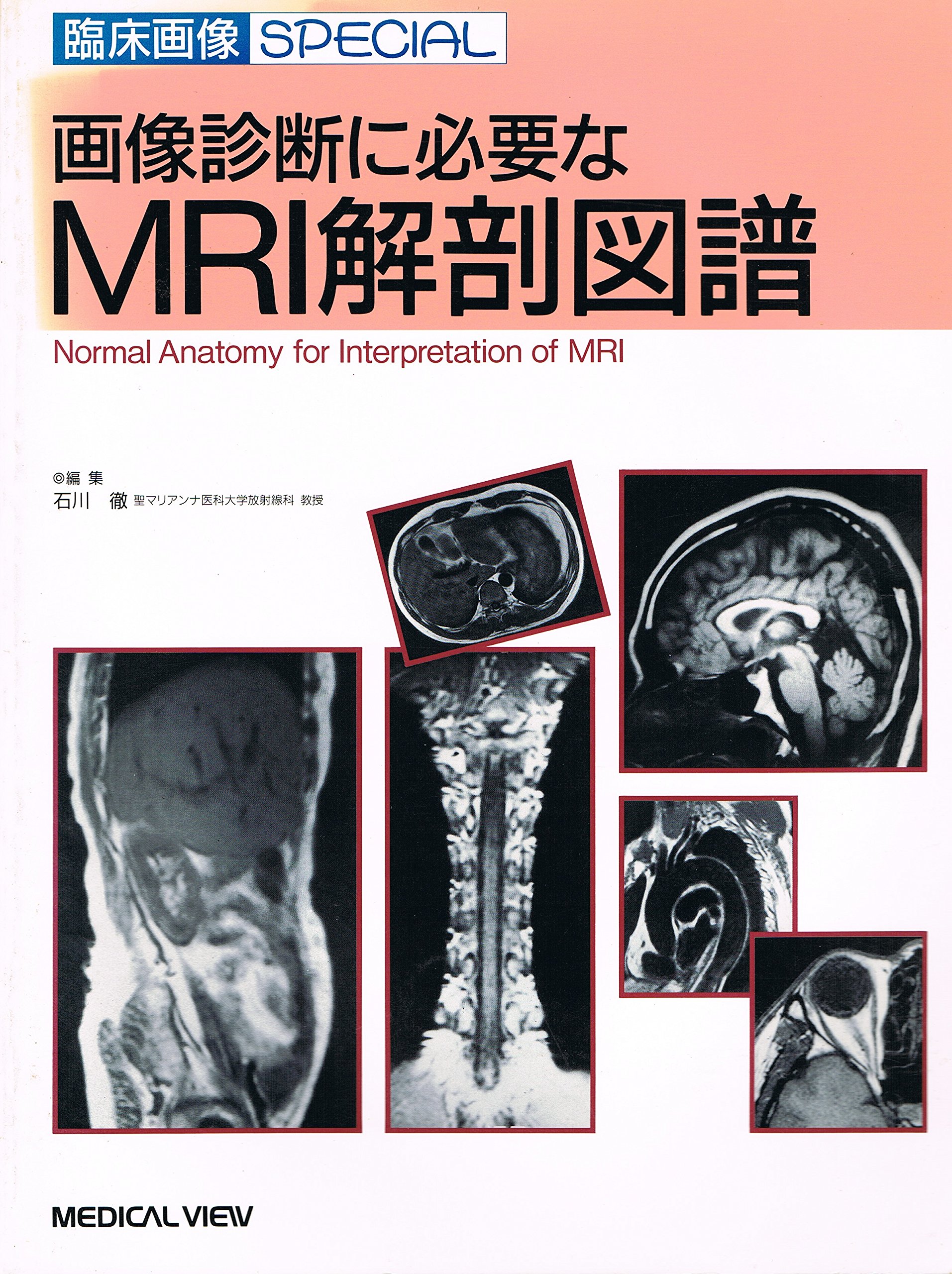 画像診断に必要なMRI解剖図譜 (臨床画像SPECIAL) | 石川 徹 |本 | 通販