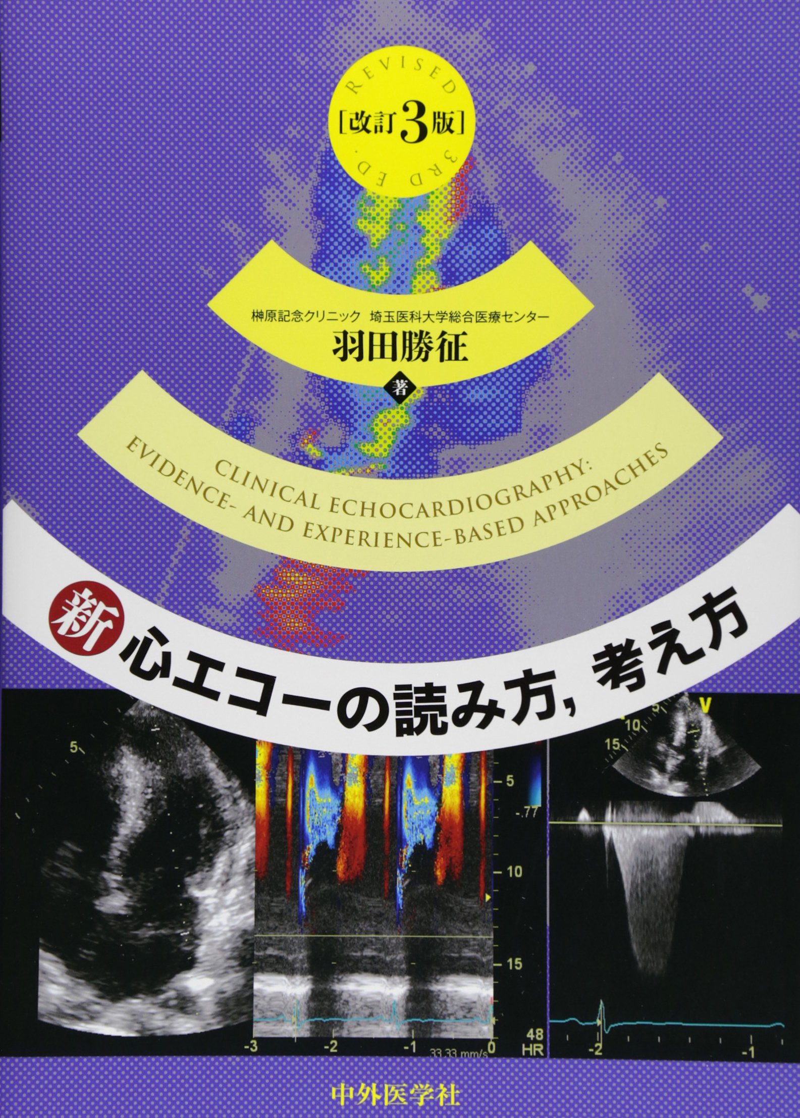 新・心エコーの読み方、考え方 改訂3版 | 羽田 勝征 |本 | 通販 | Amazon