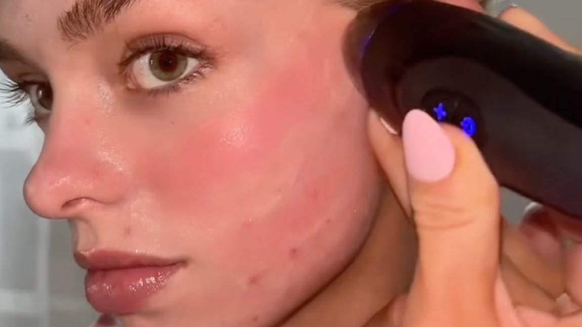 PMD Beauty Personal Microderm Man - At-Home Microdermabrasion Machine with Kit for Face & Body - Exfoliating Crystals and Vacuum Suction for Bold and Striking Skin
