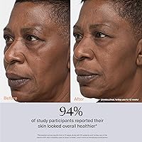 Vista 4 de TheraFace Therabody TheraFace PRO - Dispositivo facial de microcorriente, masajeador facial compacto 8 en 1 y herramienta de escultura facial