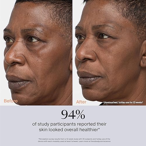 Miniatura 17 de TheraFace PRO - Dispositivo de masaje facial de mano - Herramienta eléctrica compacta de terapia para el cuidado de la cara y la piel - Tratamiento