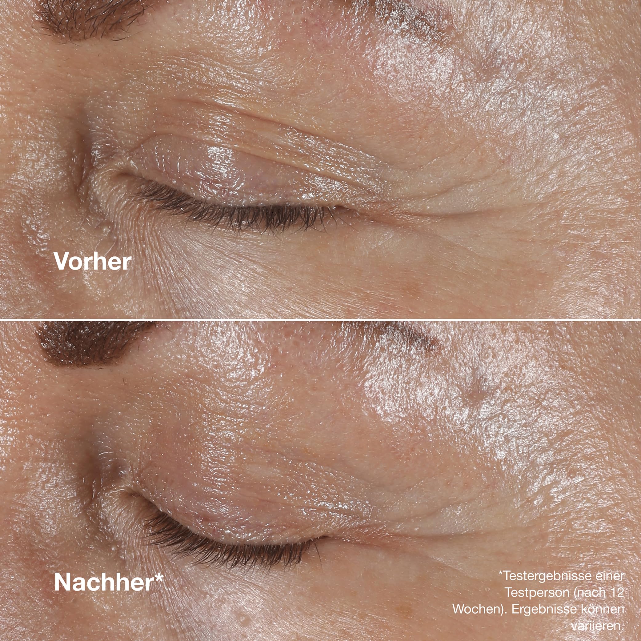 Clinique Smart Clinical Repair™ Wrinkle Correcting Eye Cream mit Peptiden + Hyaluronsäure | Anti-Aging, feuchtigkeitsspendend + abschwellend mit Massage