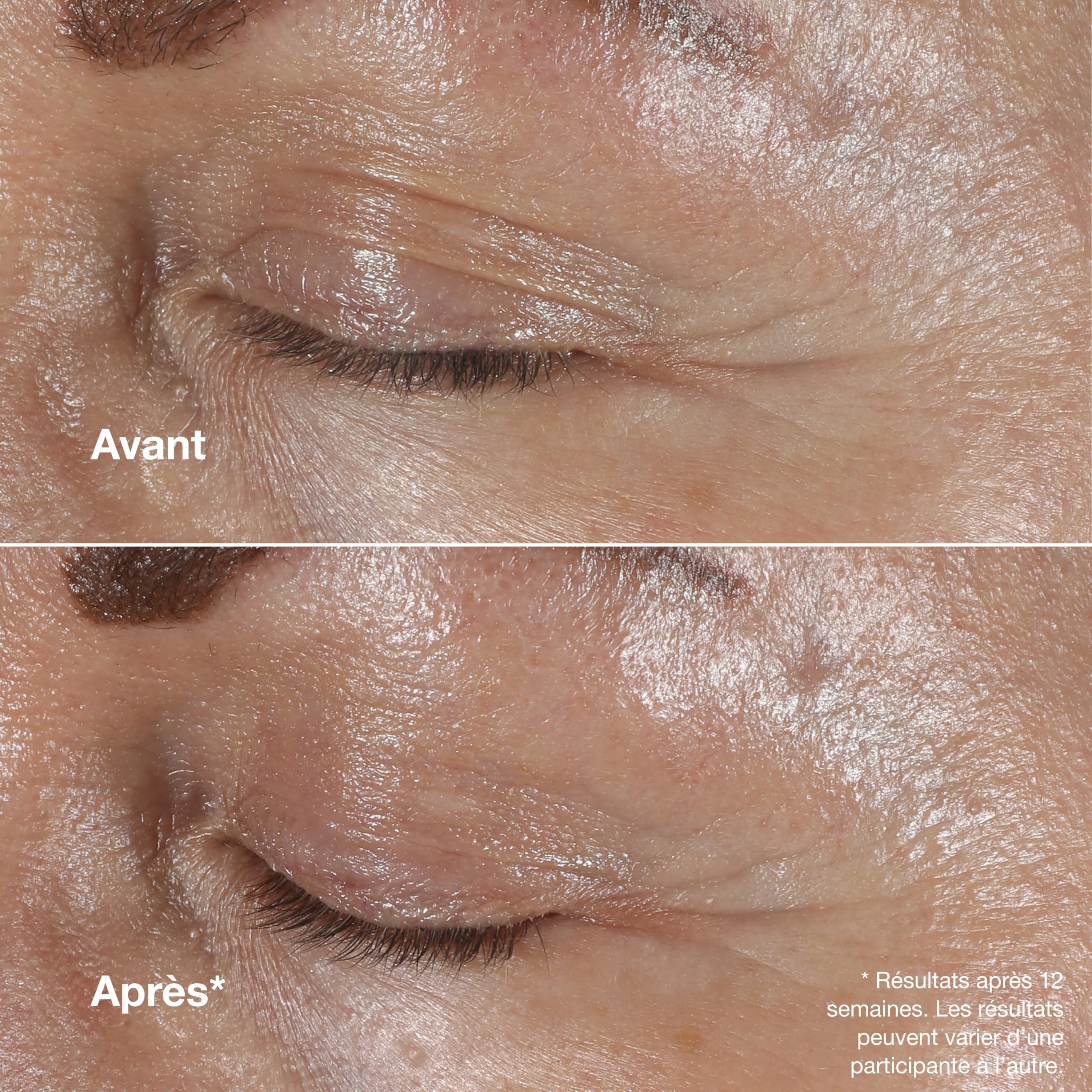 Clinique Smart Clinical Repair Crème Yeux Correctrice Anti-Rides à l'Acide Hyaluronique + Peptides | Anti-Âge, Hydratante + Décongestionnante, 15 ml