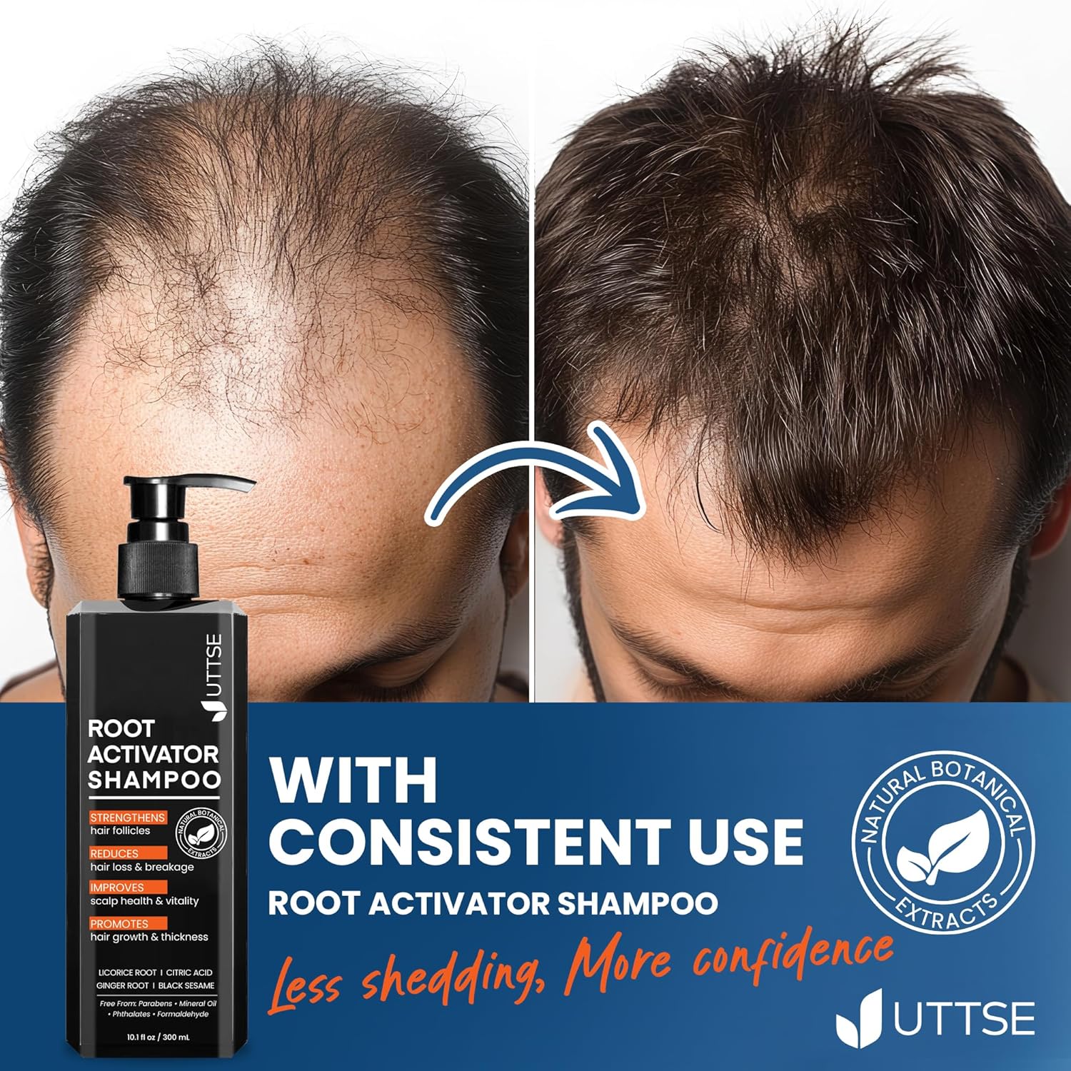 Root Activator Shampoo for Men: Hair Growth Shampoo for Hair Loss and Thinning Hair - 10.1 fl oz / 300 mL - Image 6