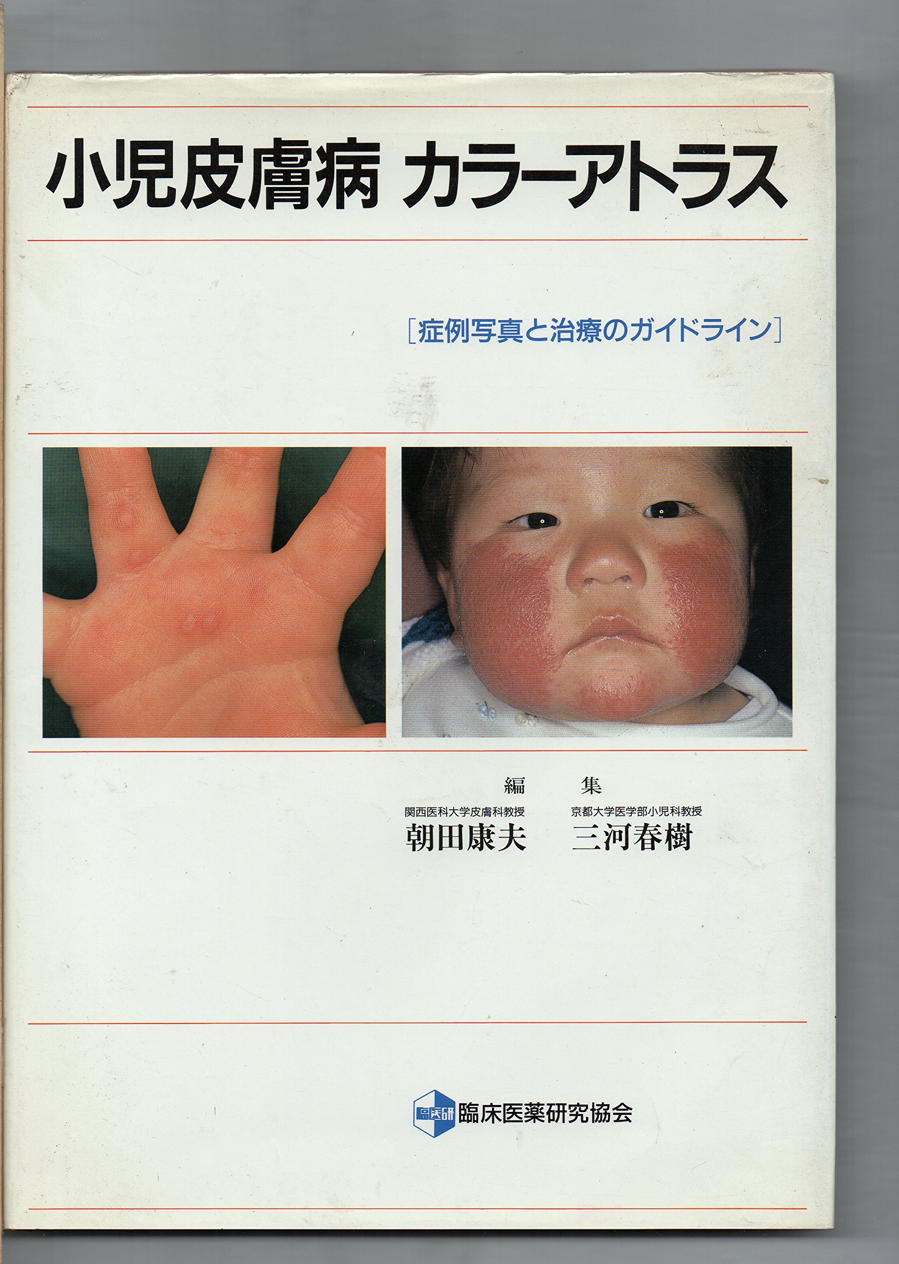 皮膚科診療カラーアトラス大系　（6） 皮膚科診療カラーアトラス大系 （6）』（鈴木 啓之,神崎 保）｜講談社