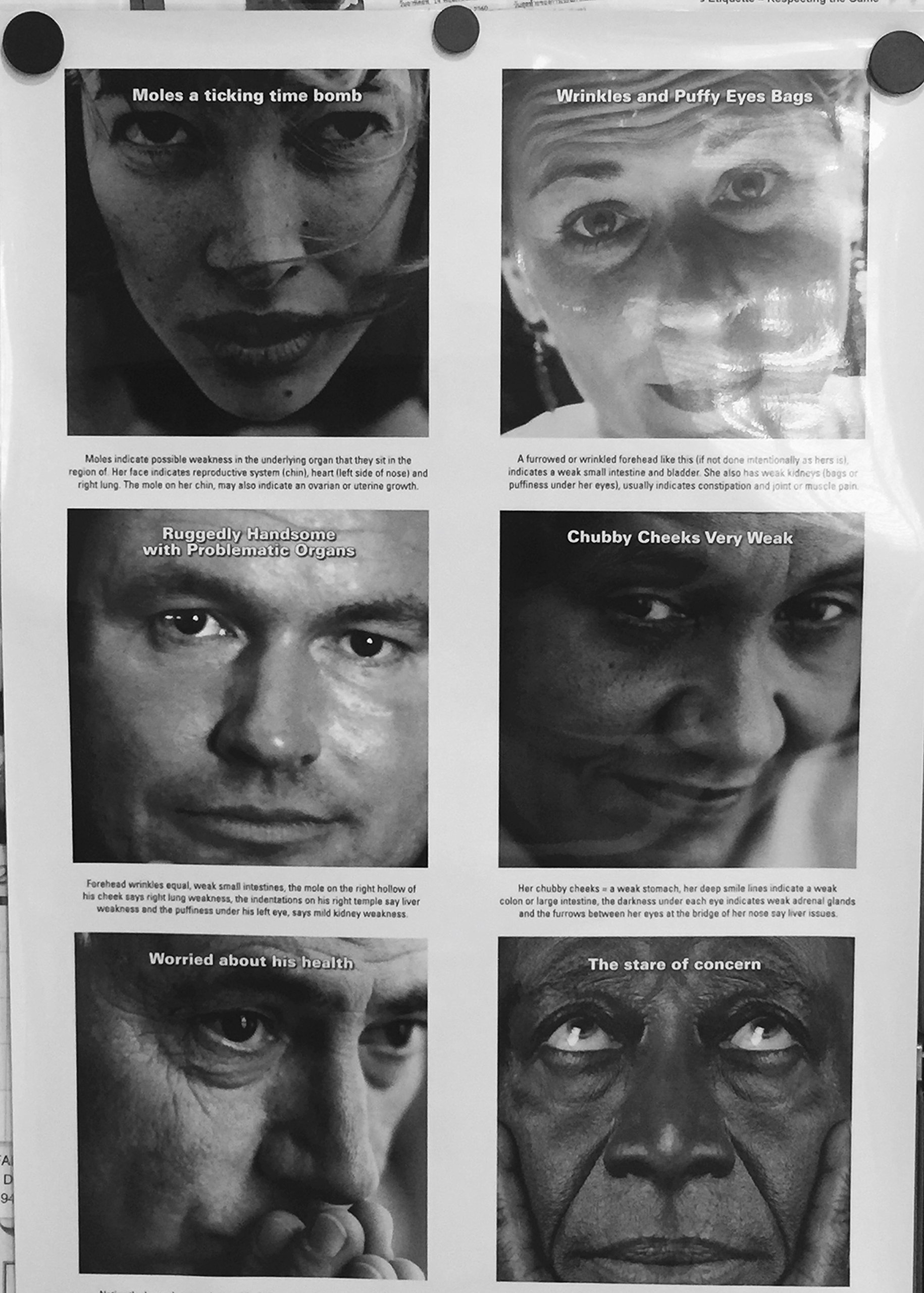 Face Readings Examples Face Reading Chart For Health Northern Health... Northern Health And
