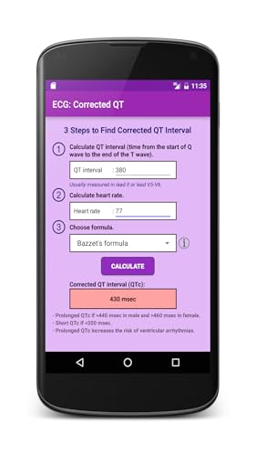 ECG: Corrected QT