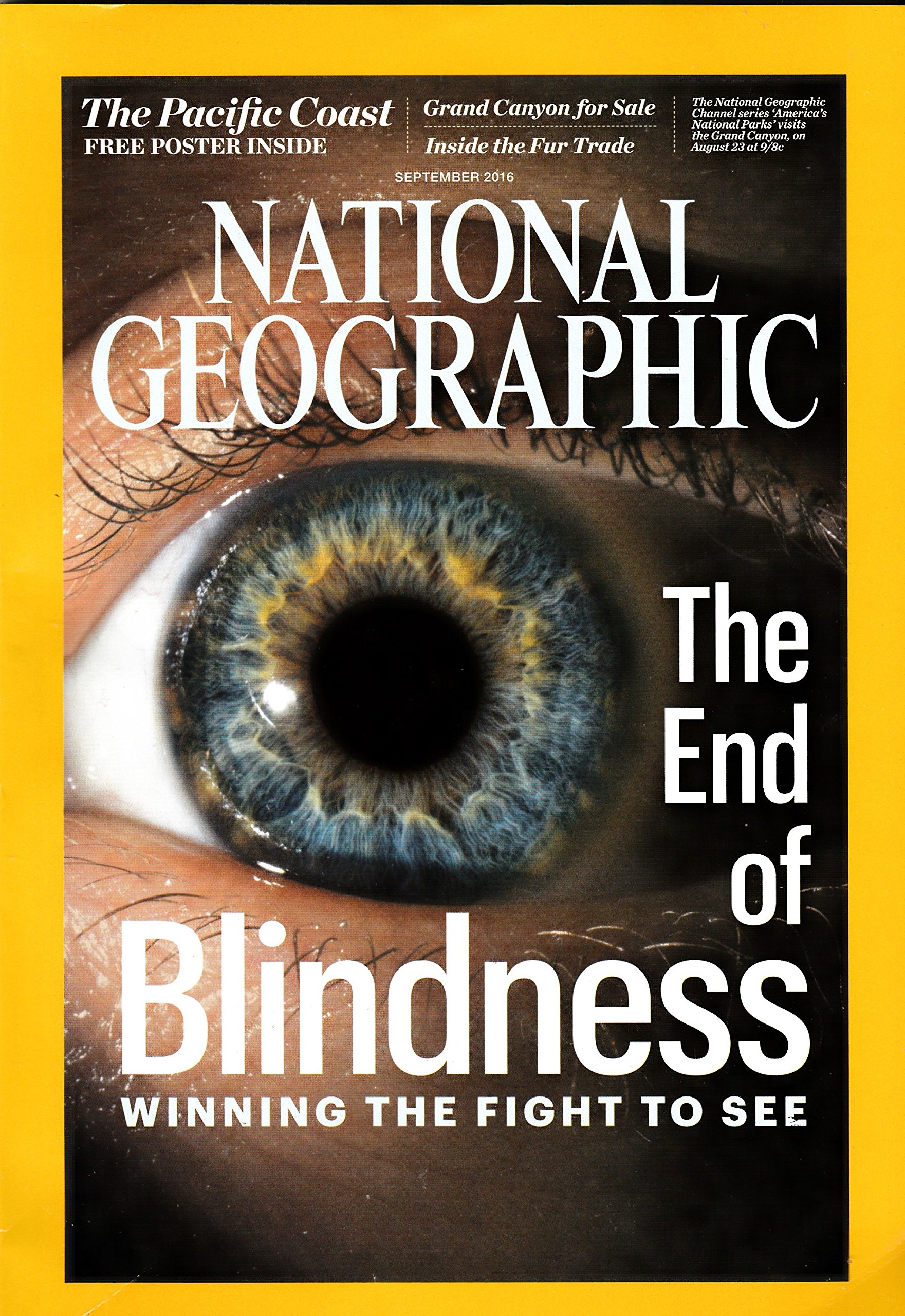 National Geographic Magazine (September, 2016) The End of Blindness
