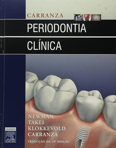 Carranza Periodontia Clínica