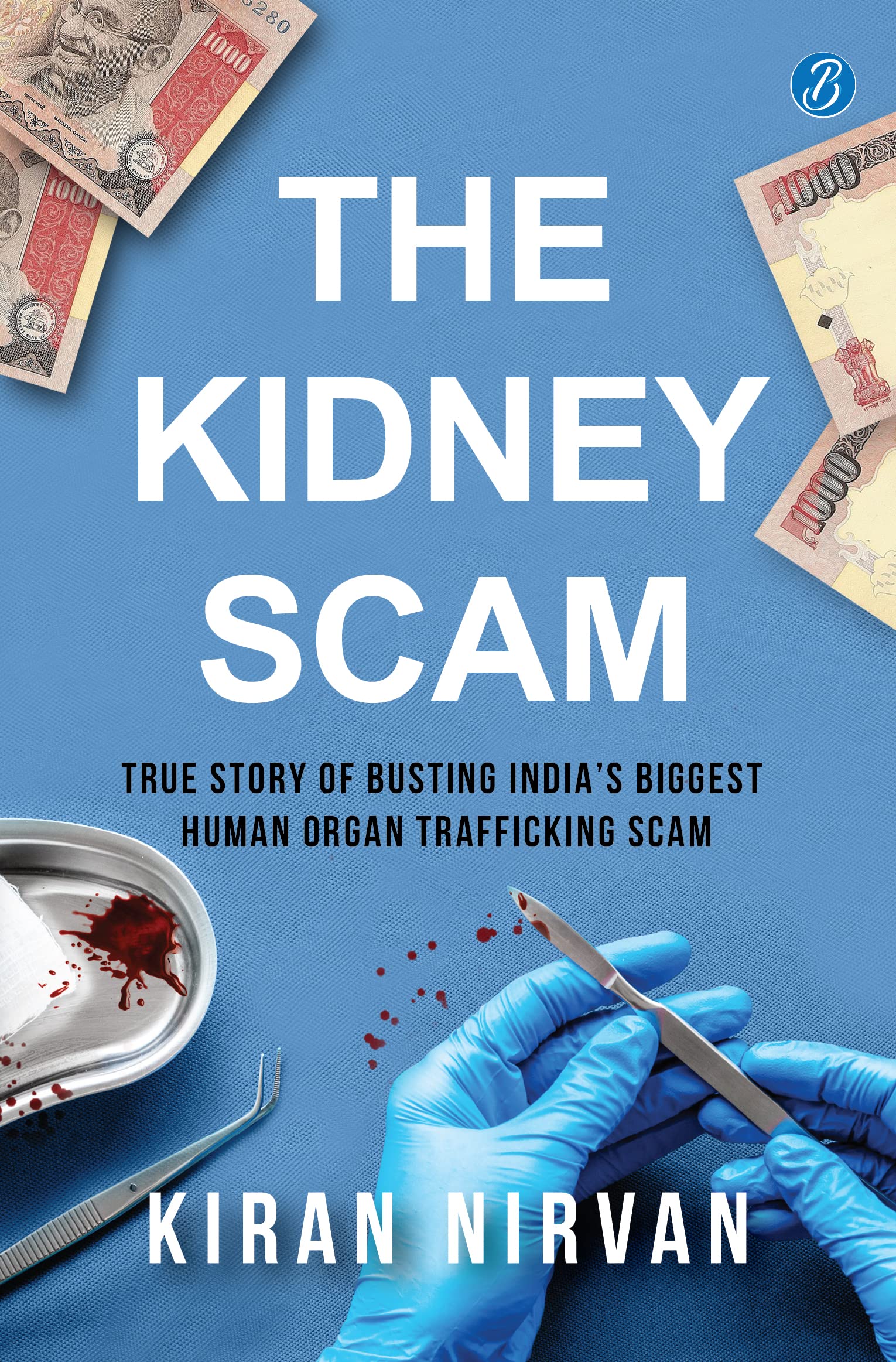 The Kidney Scam: True story of busting India’s biggest human organ trafficking scam ǀ A true crime that shocked the nation
