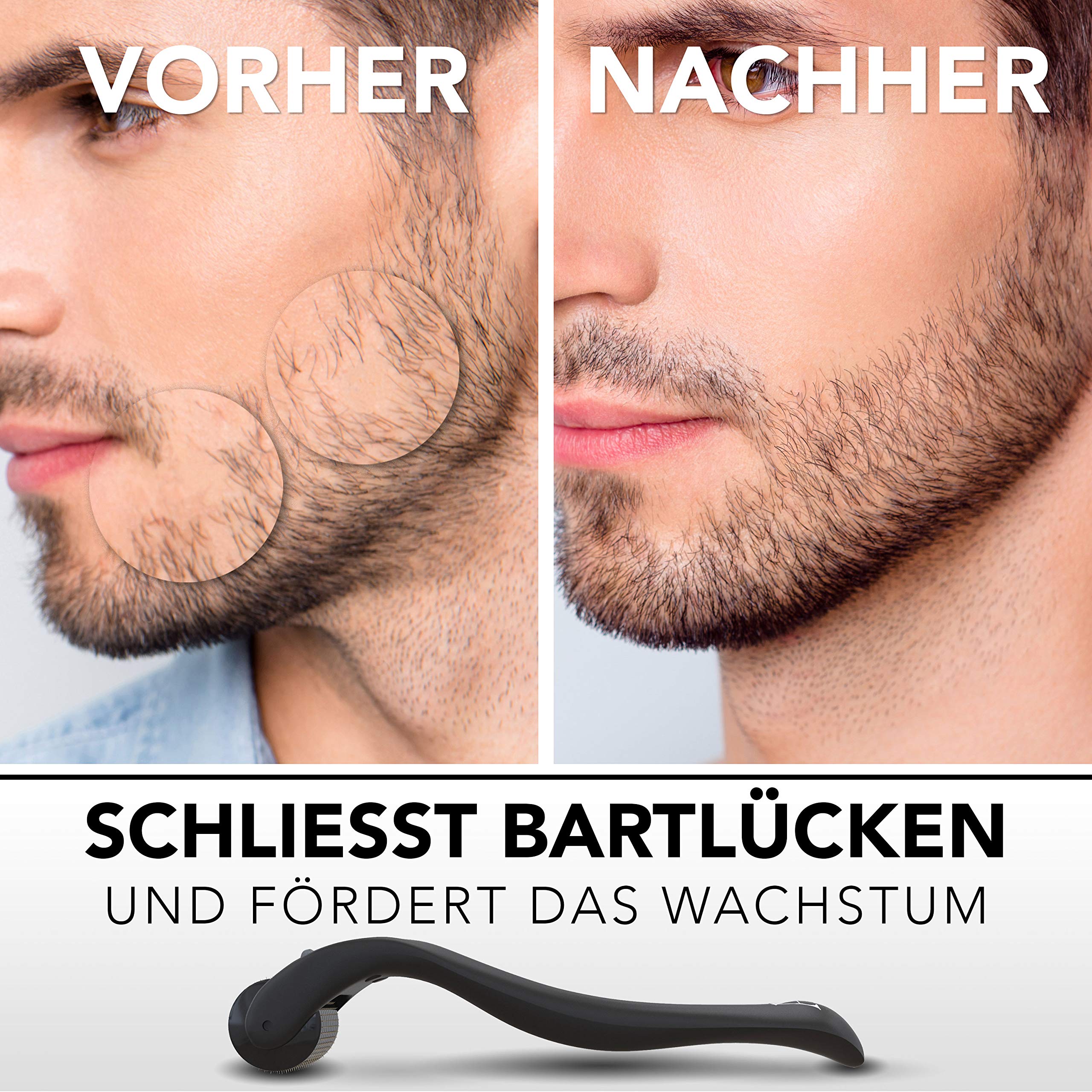 Anthony Brown® Bartroller 0,5 mm Dermaroller Set mit Reinigungsspray, Microneedling Roller für Bartpflege und Hautstimulation
