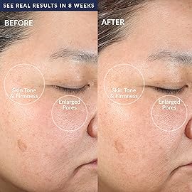 PMD Beauty: Electric Facial Cleansing Brush - Smart Facial Device with Silicone Brush & Anti-Aging Massager, Navy with Remove Balm