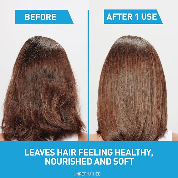 CeraVe Hydrating Anti Dandruff Shampoo and Conditioner Set, Pyrithione Zinc Dandruff Treatment With Ceramides, Hyaluronic Acid & Niacinamide, Helps Elimanate Flakes & Reduce Itchy Scalp