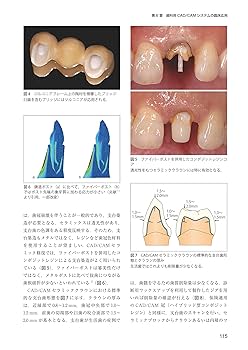 基礎から学ぶCAD/CAMテクノロジー | 日本デジタル歯科学会, 全国