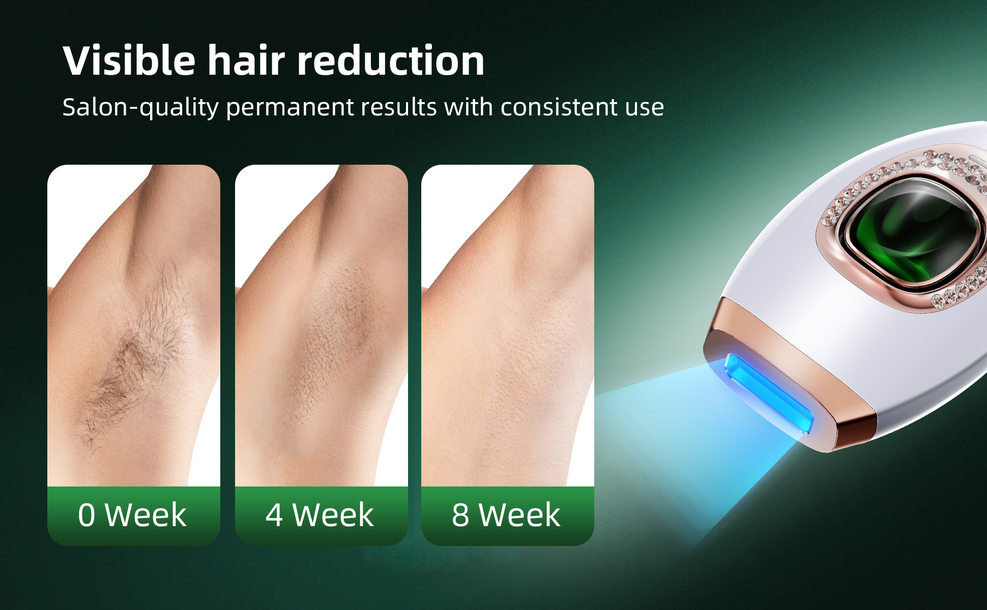 Amazon.com: IPL Hair Removal Device,Laser Hair Removal,Laser Hair