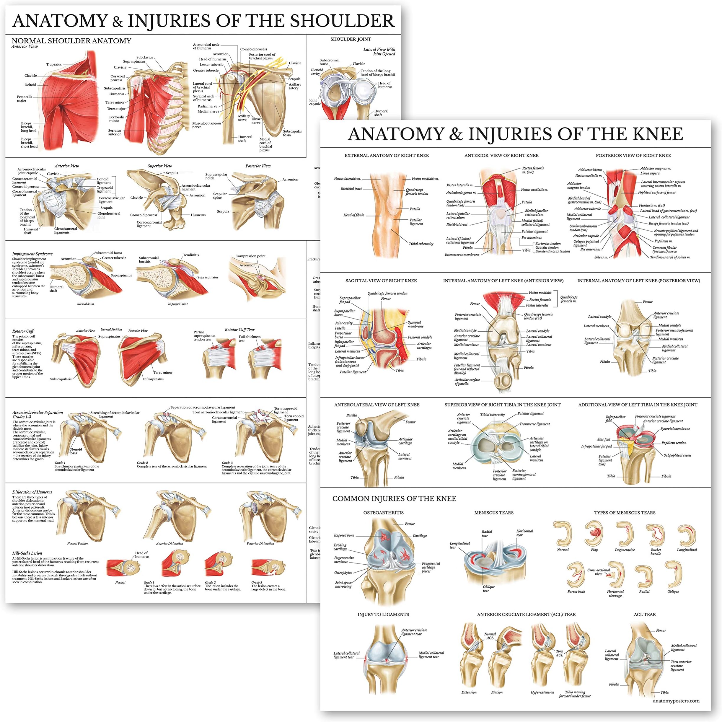 Palace Learning 2 Pack - Anatomy and Injuries of The Knee & Shoulder Poster Set - Anatomical Chart Set - Laminated 18" x 24"