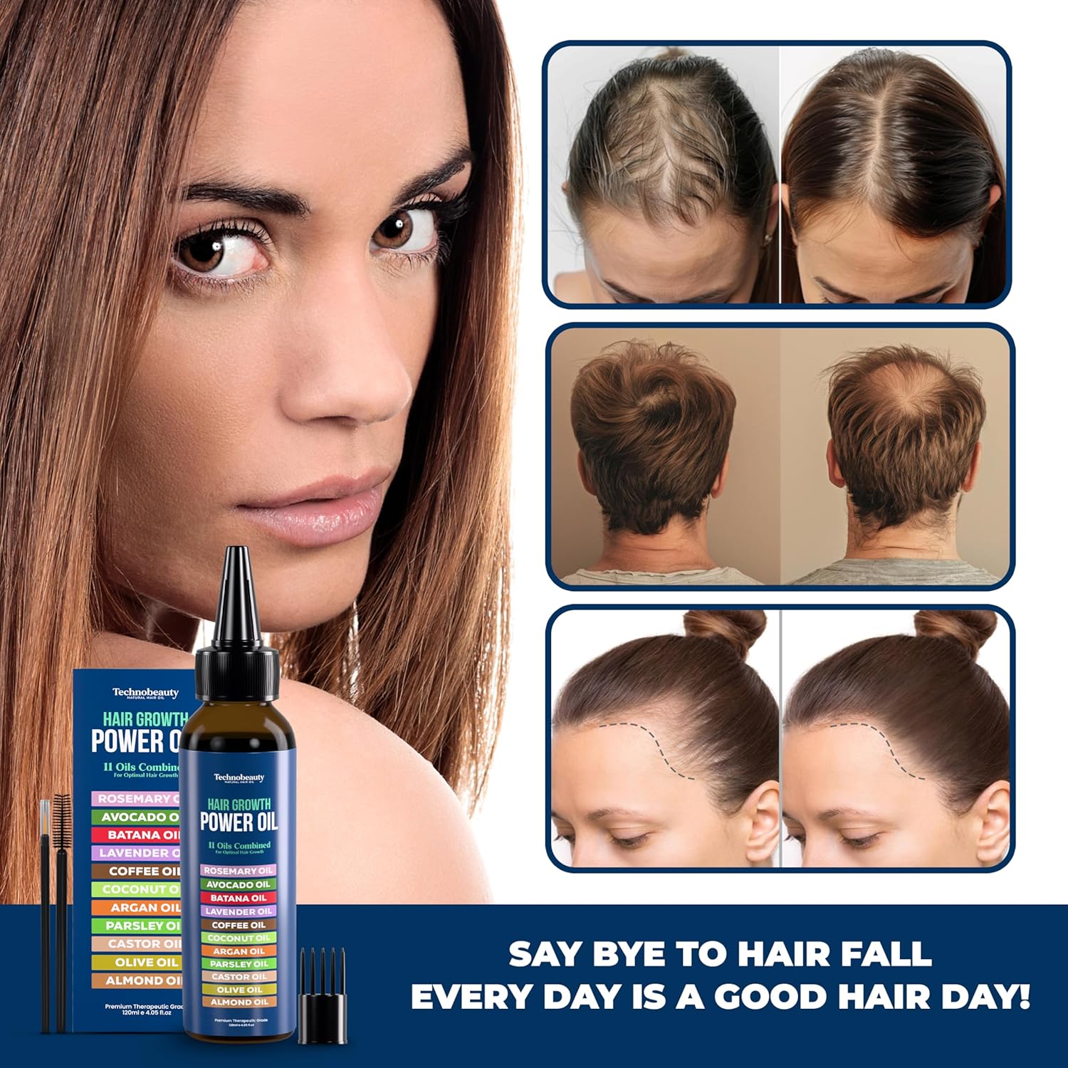 Rosemary Oil With Black Castor, Batana, Lavender, Coffee, Coconut, Argan, Avocado, Olive, Almond & Parsley Seed Oil, 11 Oils Infused for Ultimate Hair Growth (4 fl oz (120 ml)) - Image 5