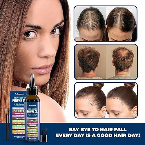 Miniatura 5 de Aceite de romero con aceite de ricino negro, batana, lavanda, café, coco, argán, aguacate, oliva, almendra y perejil, 11 aceites infundidos para el