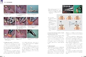 世界基準の臨床歯内療法 | 石井 宏 |本 | 通販 | Amazon