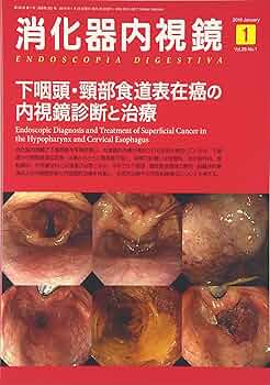 消化器内視鏡第28巻2号 粘膜下腫瘍のすべて 消化器内視鏡第28巻2号 粘膜下腫瘍のすべて