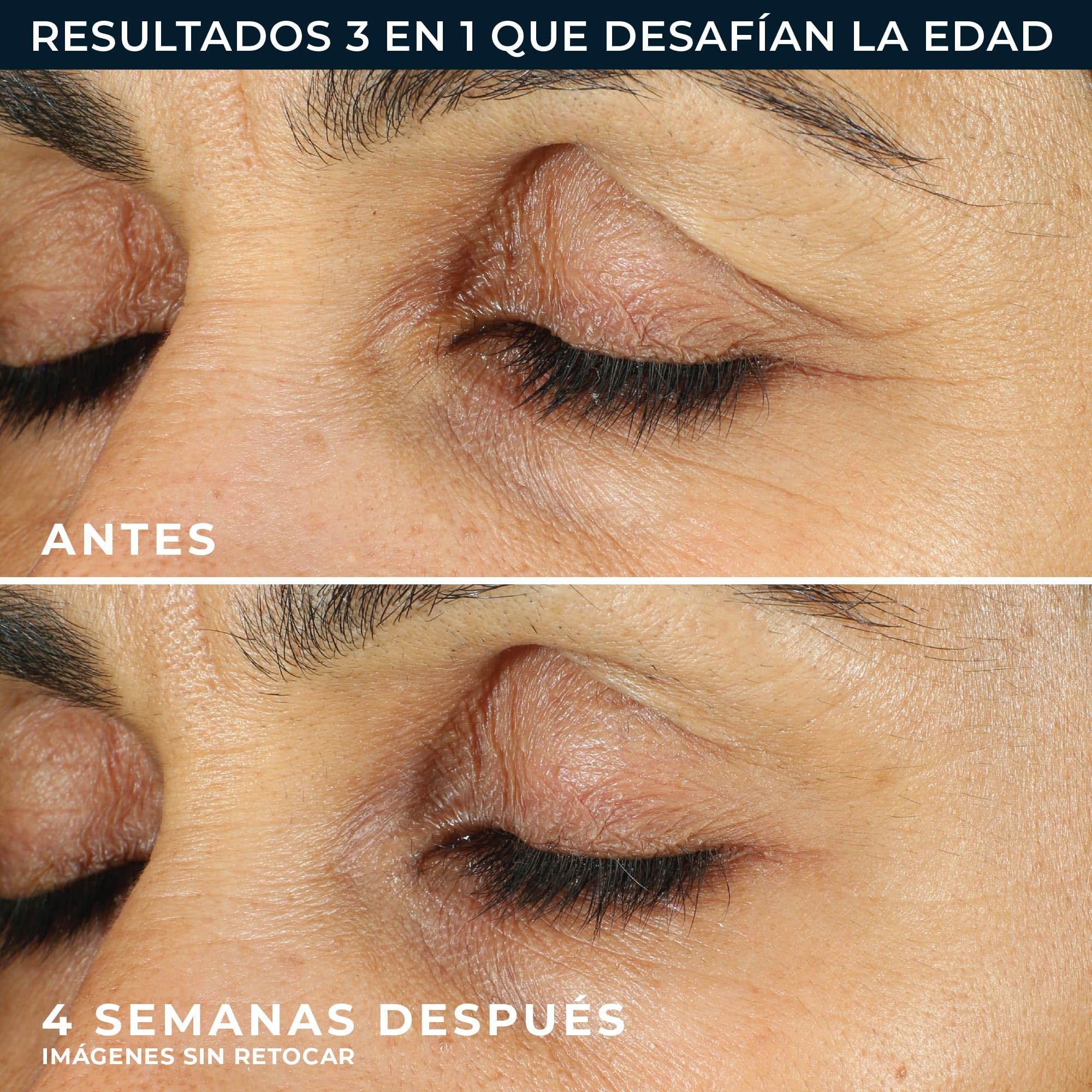 RoC - Retinol Correxion Suavizado de Líneas Crema Contorno de Ojos - Reduce Visiblemente la Hinchazón y las Ojeras - Antiarrugas y Antiedad - 15 ml