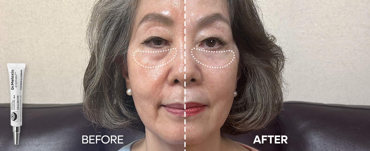 Amazon.co.jp: Dr.Melaxin(ドクターメラクチン)アイファルト アイ