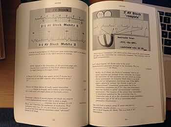 Rapid Interpretation of EKG's FOURTH EDITION: Dale Dubin