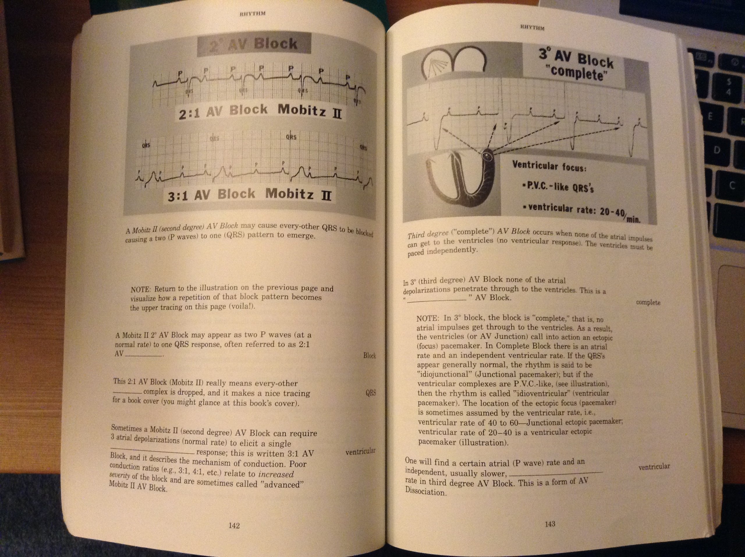 Rapid Interpretation of EKG&#39;s: An Interactive Course Dubin，Dale Rapid Interpretation of EKGs: Dale Dubin, M. D.