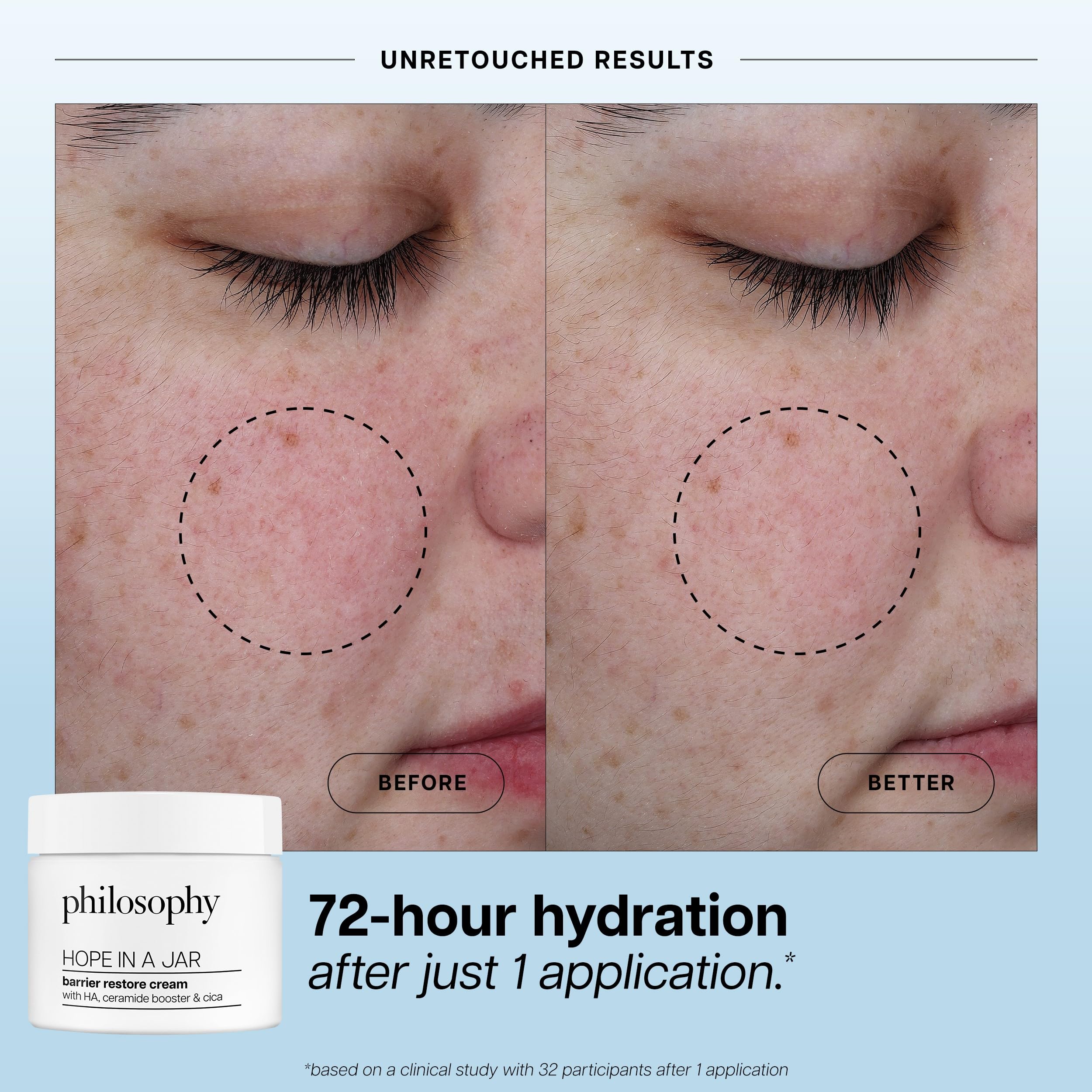 philosophy hope in a jar barrier restore cream – with ha+ complex, cica & ceramides – intensely hydrating moisturizer for dry, sensitive skin – repairs & soothes