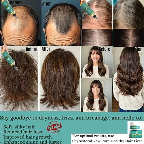 Miniatura 6 de Aceite de batana para el crecimiento del cabello  Aceite de batana 100% natural y puro para el crecimiento del cabello y fitosteroles pérdida de