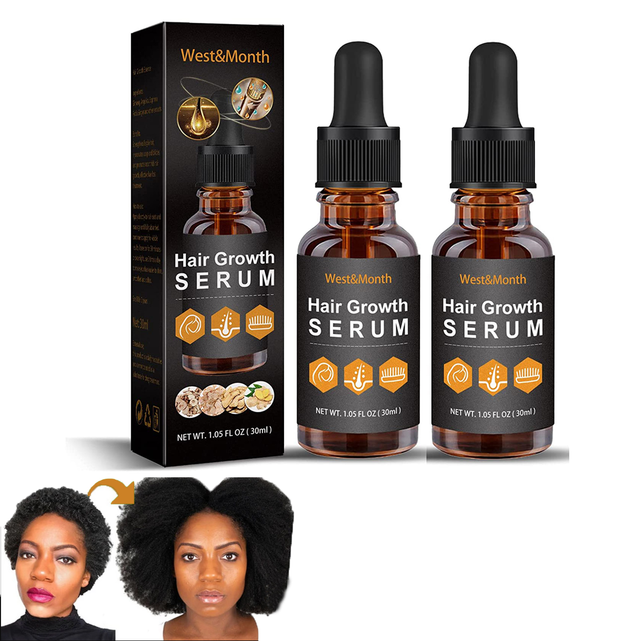 Vedix Hair Growth Serum Review - Instagram